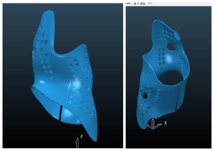 世界首例可穿戴的3D打印脊柱側(cè)彎支具在我工作室誕生! 世界首例可穿戴的3D打印脊柱側(cè)彎支具在我工作室誕生!